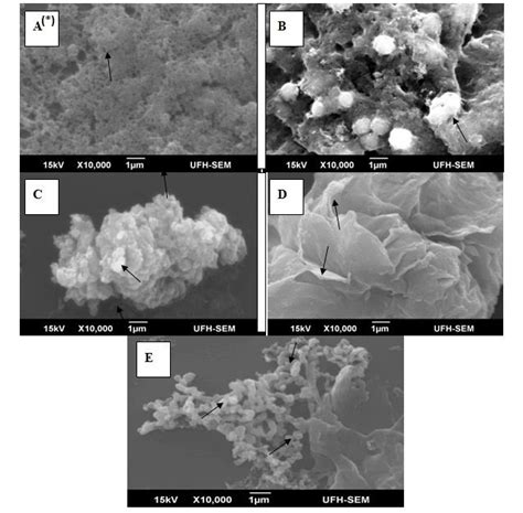 Ultrastructural Changes Of Apoptosis In MCF 7 A The Characteristic