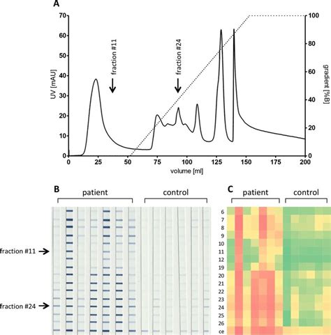 Ion Exchange Chromatography Iex Of The Insoluble Fraction Of B