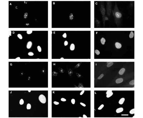 Indirect Immunofluorescence Staining Patterns Obtained Using The