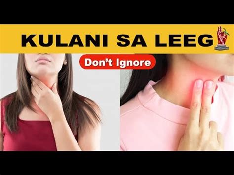 KULANI SA LEEG PAANO MAIIWASAN YouTube