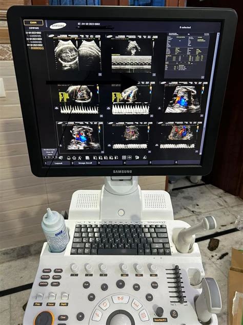 Refurbished Ultrasound Machines 4D At Rs 450000 In Varanasi ID