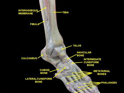 High Ankle Sprains Chicago Dpm