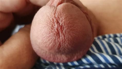 Meine Eichel 24 Pics Xhamster