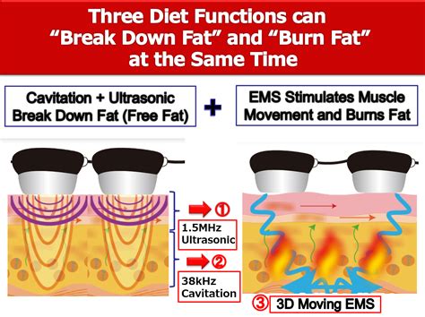 Ultrasound Fat Cavitation With Ems Shaira Star Beauty