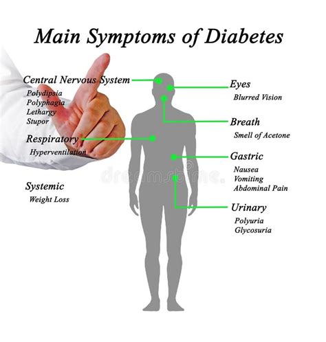 Síntomas De Diabetes Infográfica Ilustración Del Vector Ilustración