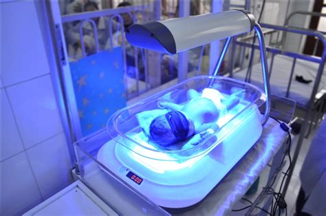 Phototherapy For Jaundice Babies