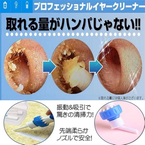 送料無料 みみきれい 電動 耳かき イヤー クリーナー 収納ケース付き 洗浄 振動＆吸引式 耳垢吸引機 耳掃除 電池式 吸引 すっきり 耳垢