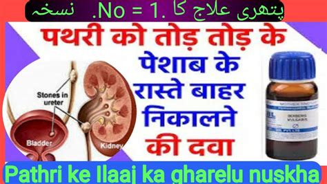 Pathri Ka Ilaj Pathri Ki Dawai Pathri Ke Lakshan Kidney Stone