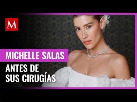 As Luc A Michelle Salas Antes Y Despu S De Sus Cirug As El Diario A