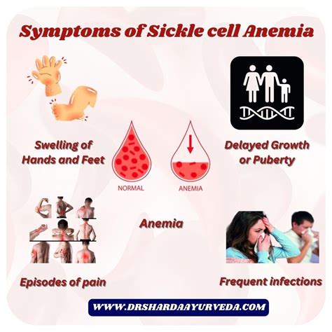 Sickle Cell Anemia And Symptoms R Liveahealthylife