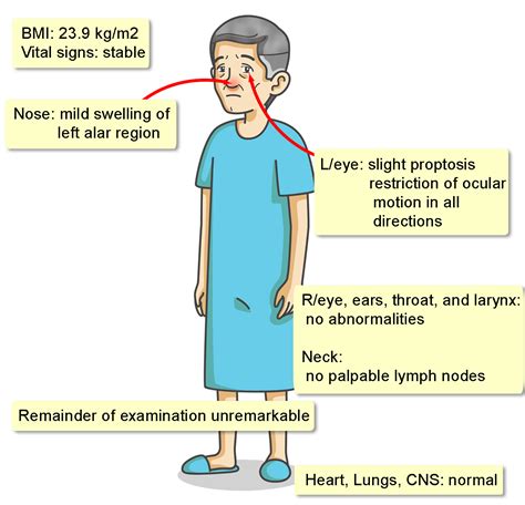 Mucosal Melanoma - Interactive case study | Clinical Odyssey by Medical Joyworks, LLC