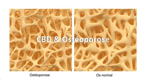 Cbd Et Ost Oporose Kannabay