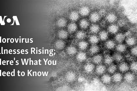 Norovirus Illnesses Rising Here S What You Need To Know