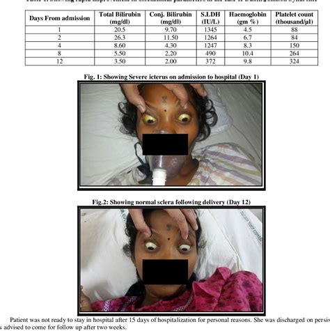 Figure 1 From Pregnancy With Dubin Johnson Syndrome A Case Report