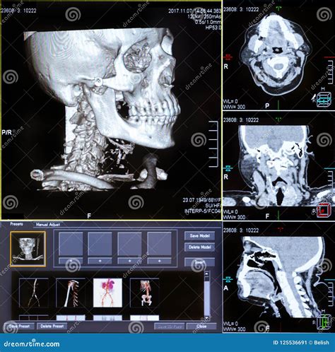 CT Scans Of Human Spine Stock Image | CartoonDealer.com #118064875