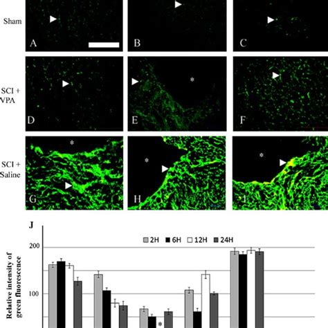 The Effect Of Valproic Acid Vpa On Glial Fibril Acidic Protein Gfap