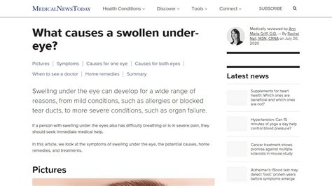 What Causes Swelling Under One Eye Beauty Tips