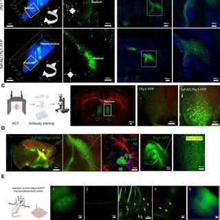 Axonal Spheroids Are Formed In The Hippocampo Septal Tracts Of Xfad