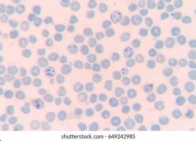 Reticulocyte New Methylene Blue Staining Stock Photo 649242916 | Shutterstock