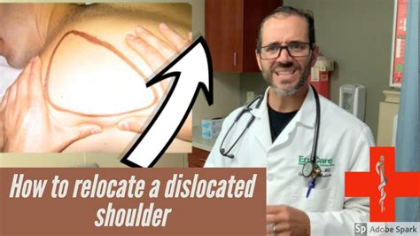 How To Put A Shoulder Back Dislocated Shoulder Treatment Youtube