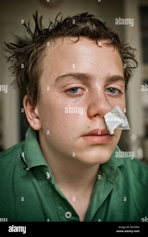 Niño De 13 Años De Edad Con Un Pedazo De Papel Tejido En Su Nariz Fotografía De Stock Alamy