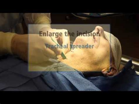 Cricothyroidotomy 2 - YouTube