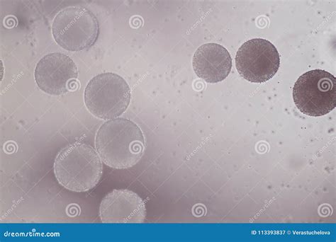 Pollen - Microscopic Photo from Microscope Stock Image - Image of ...