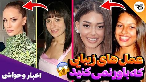 تعجب می کنید اگه این عمل های زیبایی بازیگرهای زن ترک رو ببینید YouTube