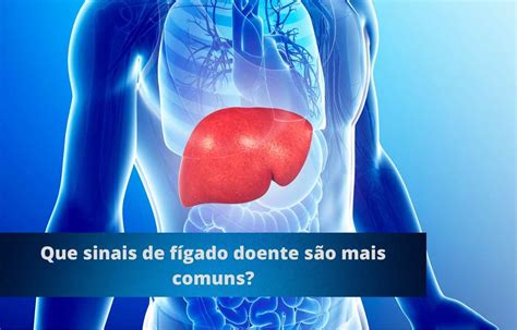 Quais podem ser os sinais de fígado doente e como diagnosticar Blog