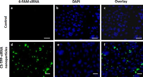 Internalization And Localization Of 6 FAM Labelled SiRNA Loaded CS TPP