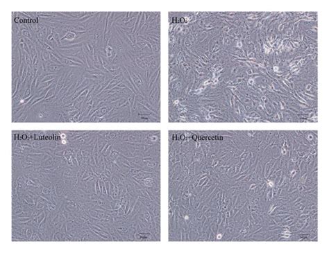 Morphologic Changes Of H9C2 Cells Induced By H2O2 With Without