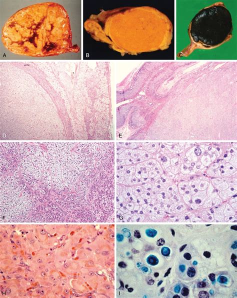 Adrenal Gland Basicmedical Key