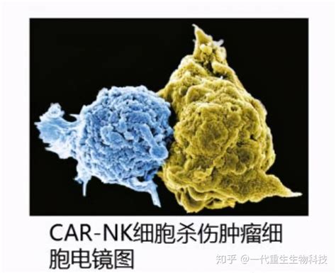 Car Nk细胞疗法，疗效提升，副作用降低 知乎