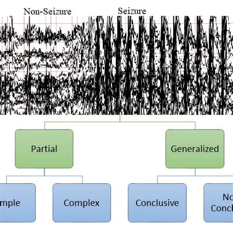 Symptoms of epileptic seizure [23]. | Download Scientific Diagram