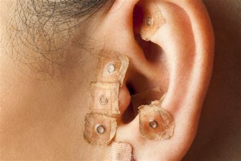 Puntos De Acupuntura En La Oreja Gu A Completa Ccfprosario Ar