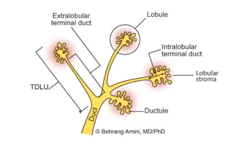 Breast Cancer Biology Flashcards Quizlet