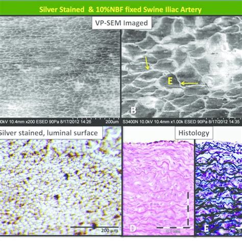 Variable Pressure Scanning Electron Microscopy Vp Sem Imaged Luminal