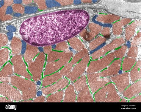 False Colour Transmission Electron Microscope Tem Micrograph Of A