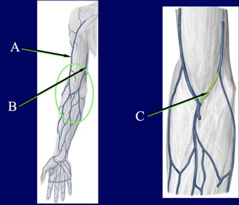 Block 3 Cubital Fossa Forearm Flashcards Quizlet