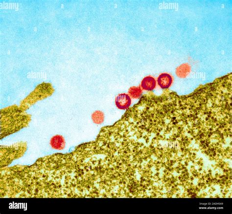 Aids Virus Particles Budding From The Membrane Of Their Host Cell