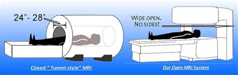 Closed MRI vs Open MRI