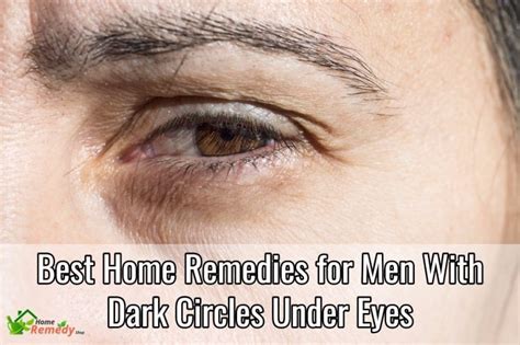 Best Home Remedies for Men with Dark Circles Under Eyes - Home Remedies