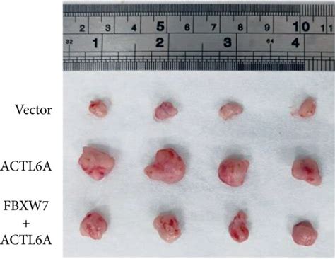 Fbxw7 Regulates Actl6a Expression Levels To Inhibit Hcc Growth In Vivo Download Scientific