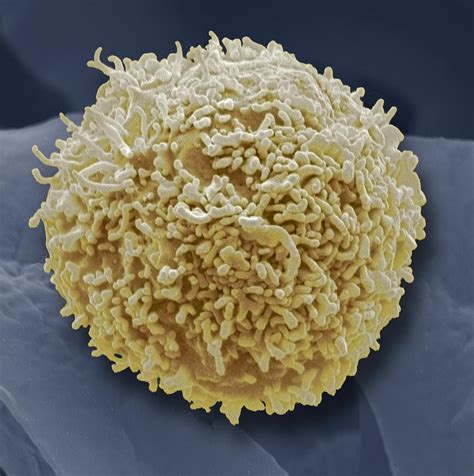 Lymphocyte White Blood Cell, Sem Photograph by Steve Gschmeissner - Pixels