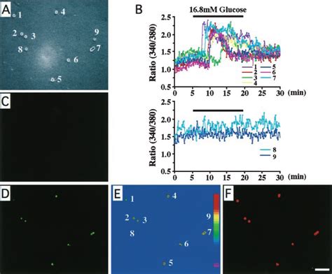 Measurement Of Nbdg Uptake And Ca I In Pancreatic Islet Cells