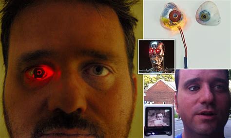 Eyeborg Filmmaker Has A Video Camera In His Prosthetic Eye That Can