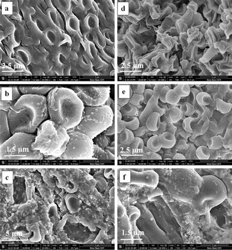 Scanning Electron Microscopy Of Trichoderma Biomass Grown Without Metal