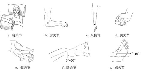 七、四肢各关节功能位的摆放 临床医学 医学