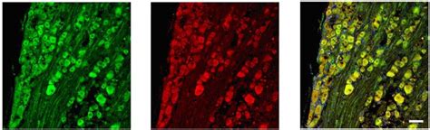 Confocal Images Of TMEM16A And TMEM16B Subunits Expressed In The L 4 6