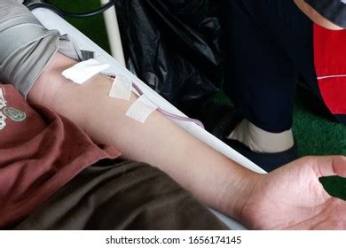 Blood Donation Needle Stuck Arm Concept Stock Photo